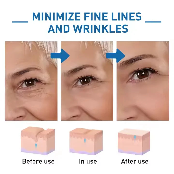 🐝💎 Botox Bee Venom Wrinkle Removal Cream 💎🐝