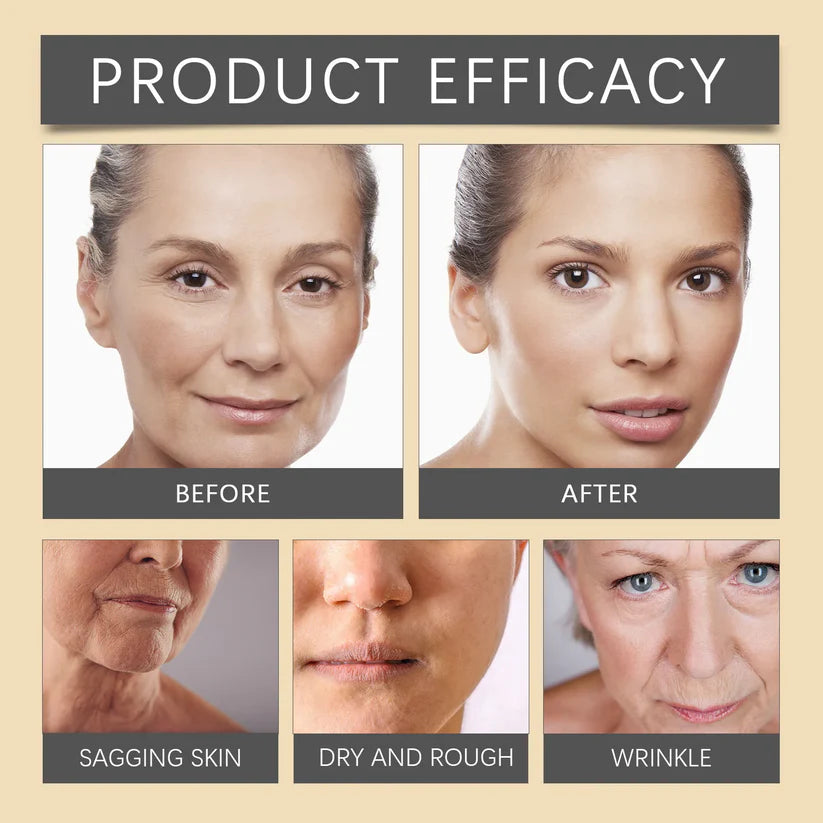 🐝💎 Botox Bee Venom Wrinkle Removal Cream 💎🐝