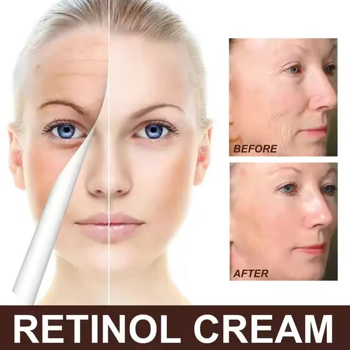 🐝💎 Botox Bee Venom Wrinkle Removal Cream 💎🐝