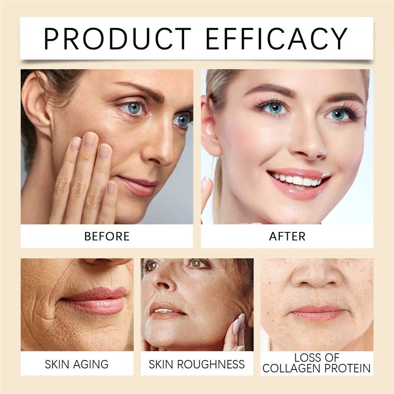 🐝💎 Botox Bee Venom Wrinkle Removal Cream 💎🐝