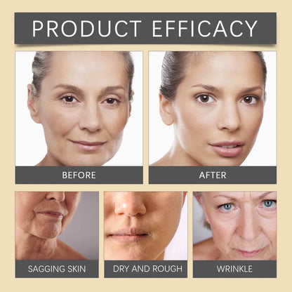 🐝💎 Botox Bee Venom Wrinkle Removal Cream 💎🐝