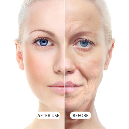 🐝💎 Botox Bee Venom Wrinkle Removal Cream 💎🐝