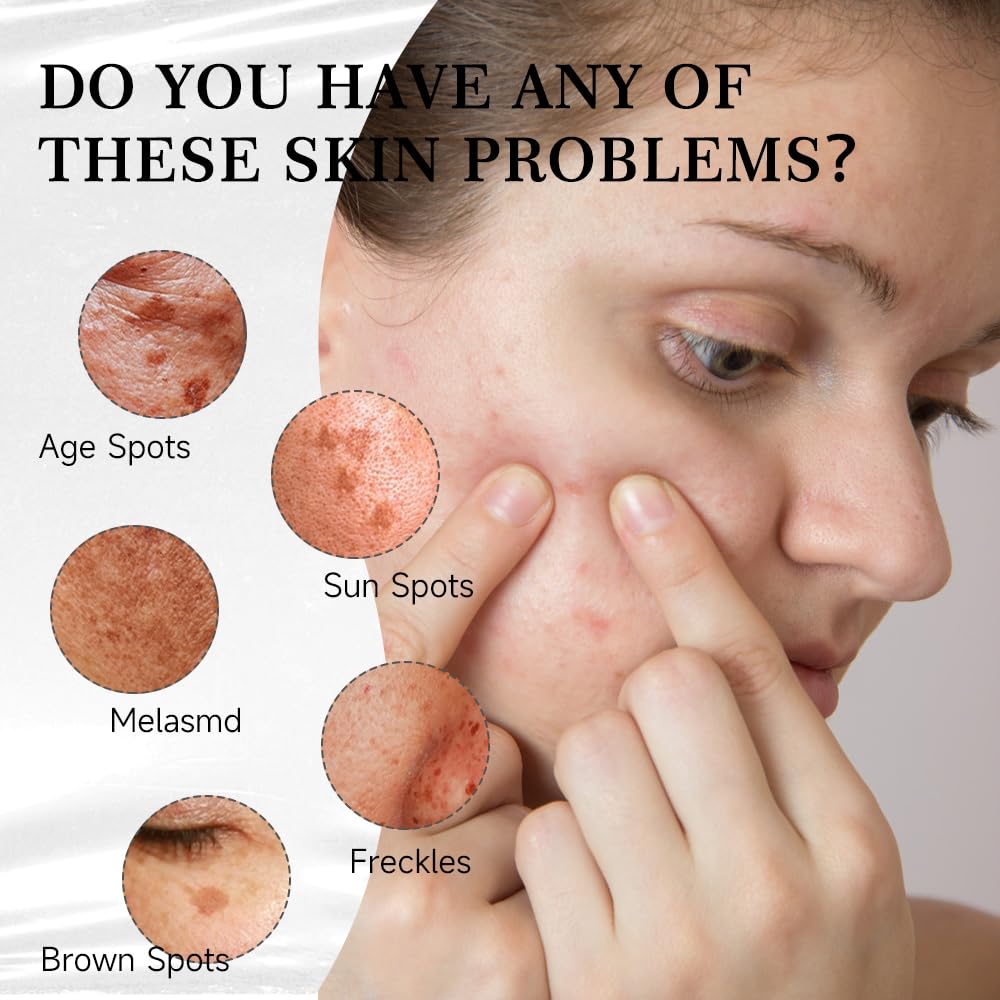 Final 3 Hours: 60%OFF🔥 Aobenz Dark Spot Remover