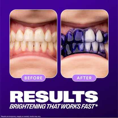 HiSmile V34™ – No More Yellow Stains, Just Bright Smiles